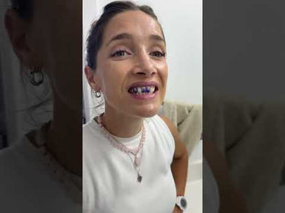 SmileKit V34 - Tus dientes más blancos
